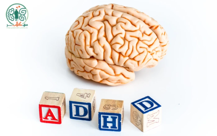 درمان بیش فعالی (ADHD)