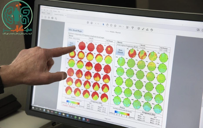 نقشه مغزی چیست و چه کاربردهایی دارد؟