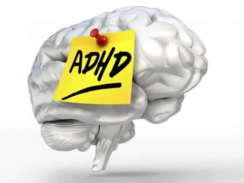 تشخیص بیش ‌فعالی با نقشه مغزی چگونه است؟