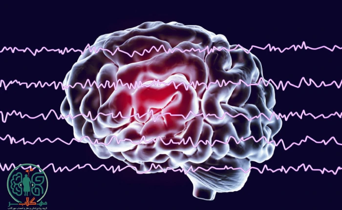 فرق نوار مغزی با نقشه مغزی 