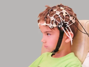 نوار مغز کودکان (EEG)
