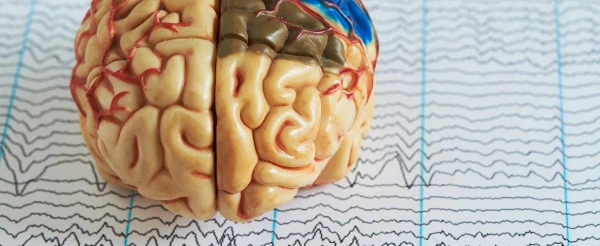 بهترین کلینیک برای نوار مغزی بدون عوارض