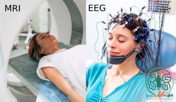 تفاوت ام آر آی با نوار مغزی
