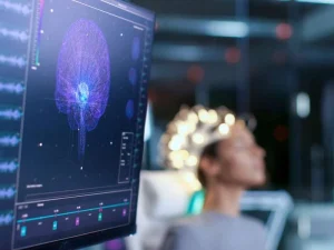 نوروفیدبک چیست