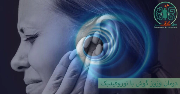 درمان وزوز گوش با نوروفیدبک 